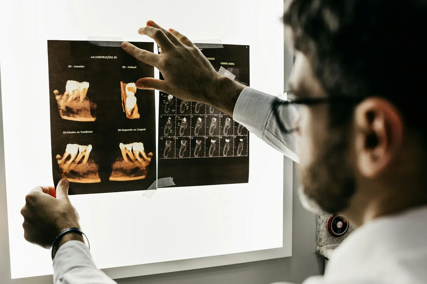 Dentist reviewing dental x-rays on a light box